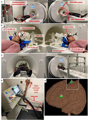 Concurrent TMS-fMRI: Technical Challenges, Developments, and Overview of Previous Studies